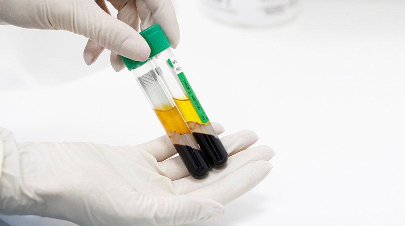 акция